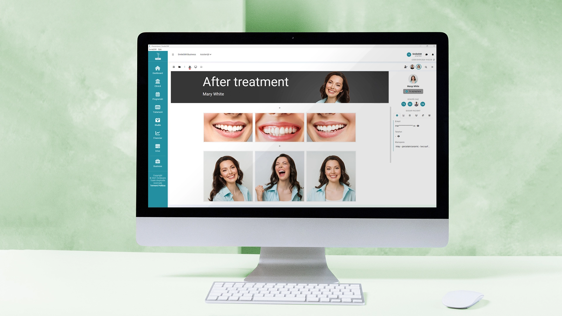 Aperçu des fonctionnalités de l'application logicielle du module Studio
