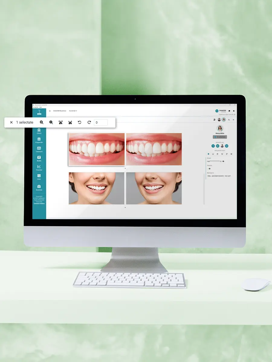Édition de photos fonction d'application logicielle