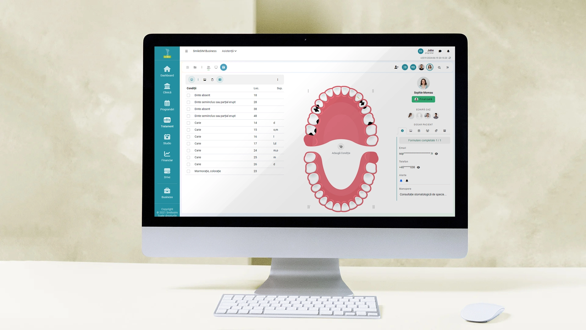 Aperçu des fonctionnalités de l'application logicielle du module Plan de traitement